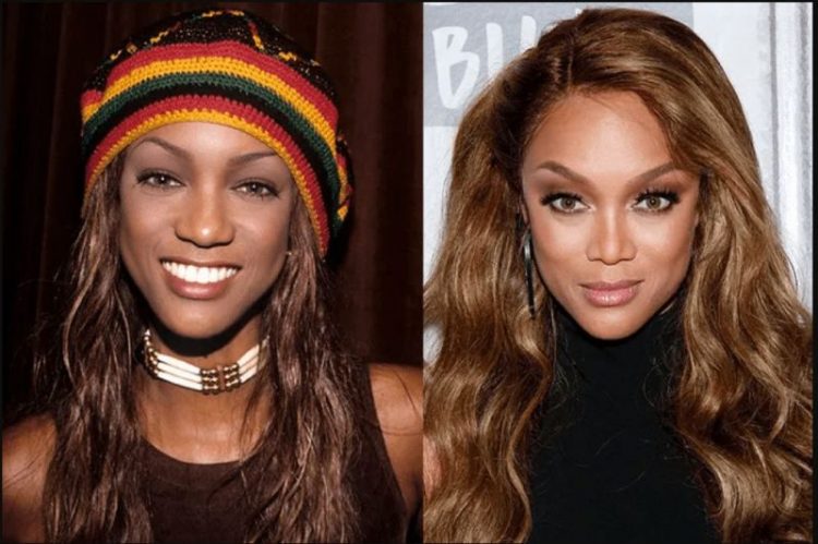 Before and After Plastic Surgery: Stunning Transformations