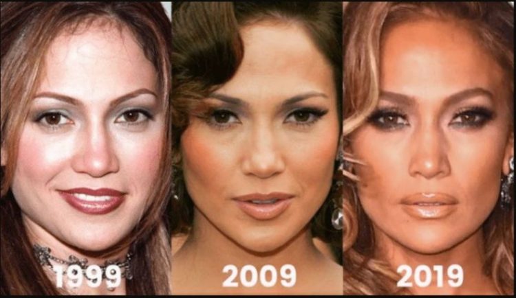 Before and After Plastic Surgery: Stunning Transformations
