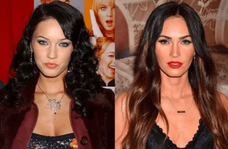 Before and After Plastic Surgery: Stunning Transformations