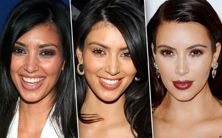 Before and After Plastic Surgery: Stunning Transformations